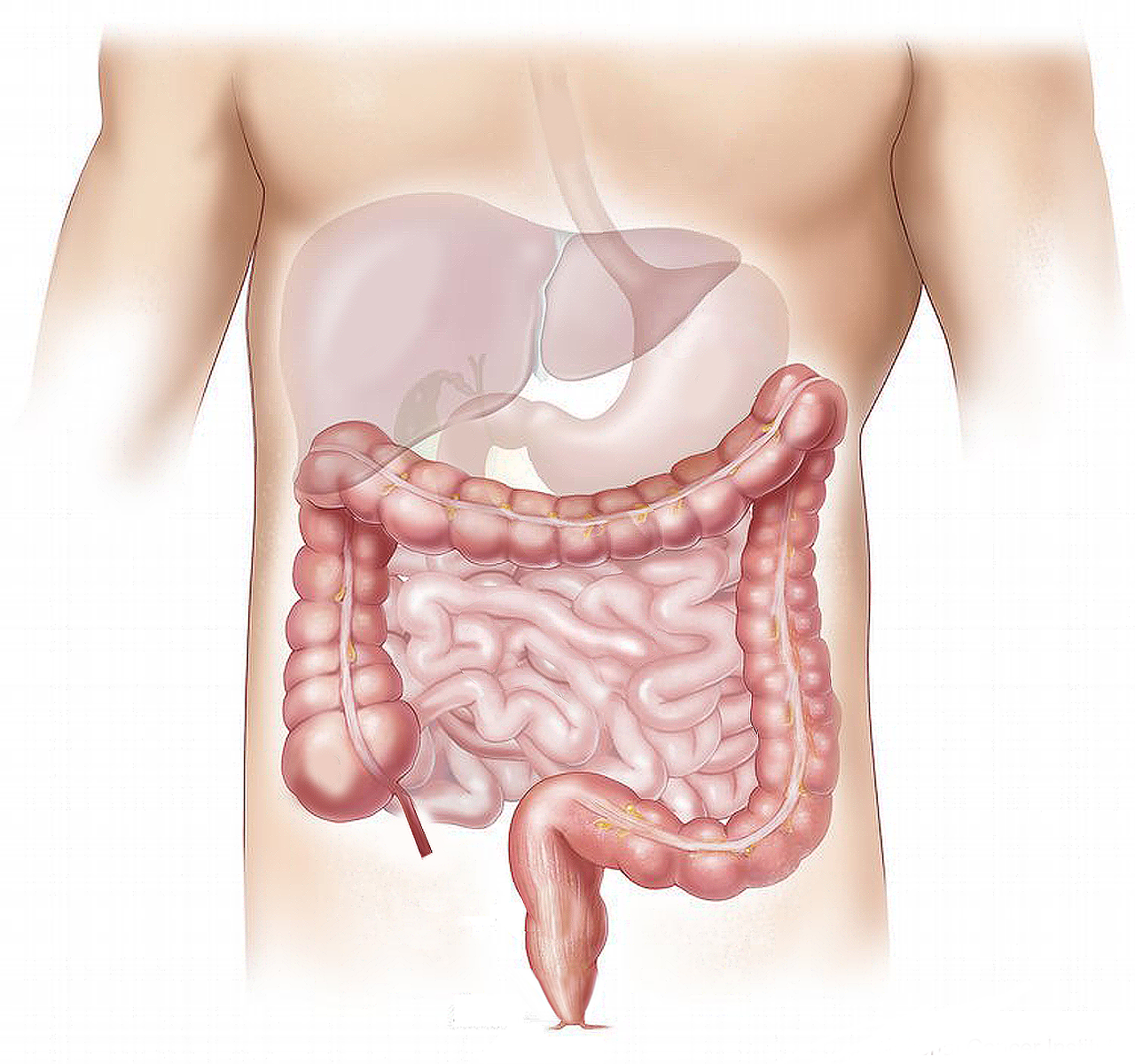 Fecal Microbiota Transplantation Linked To Sepsis Death Cases