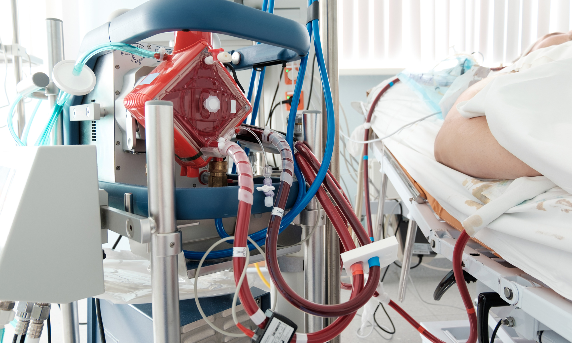 What is ECMO?