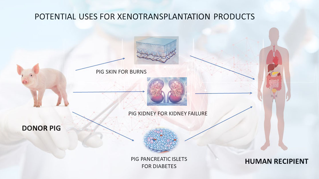 What is Xenotransplantation?