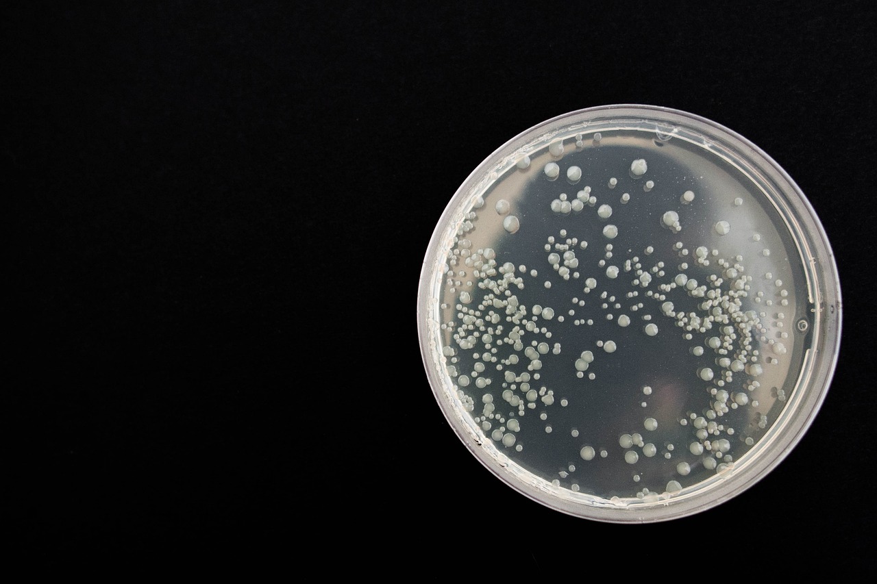 The Case Study of the Environmental Superbug: Pedobacter