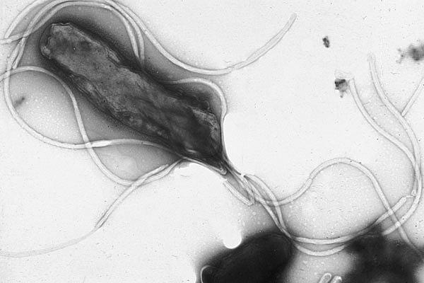 H. pylori Inhibits Heat Shock Protein Production